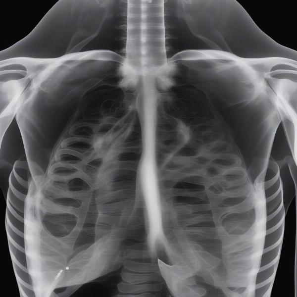 Dog X-ray Showing Aspiration Pneumonia